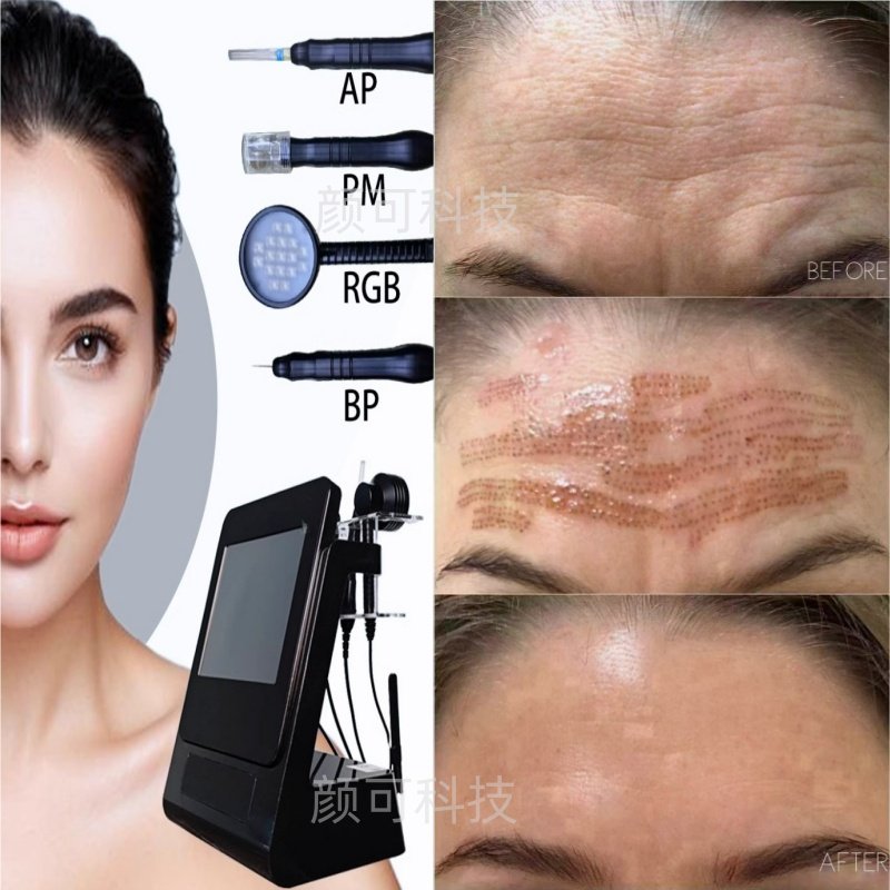 新款等离子双眼皮提拉紧致祛斑美容仪杀菌除螨修护皮肤冷离子仪器,淘宝优惠券,粉丝福利购,淘宝优惠卷