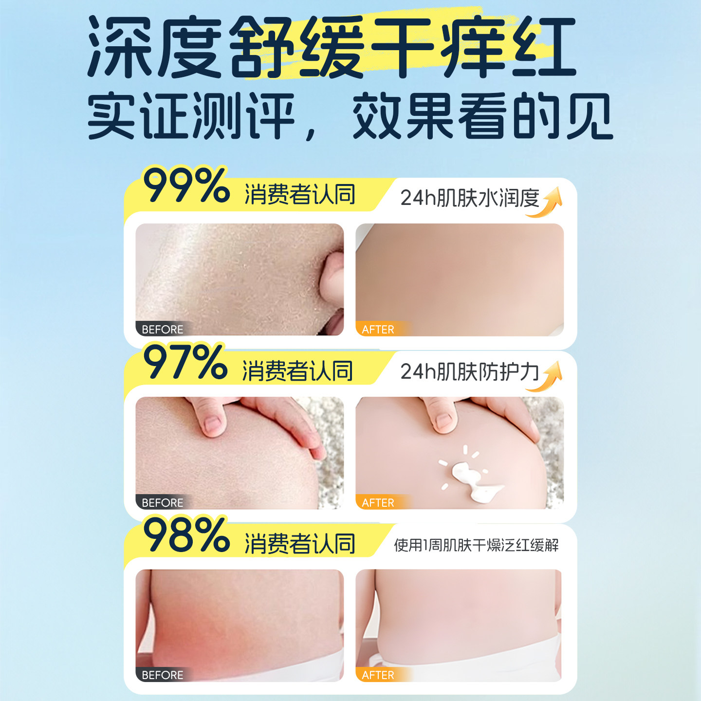 美国加州宝宝金盏花身体乳婴儿润肤乳液儿童面霜干燥止痒保湿滋润