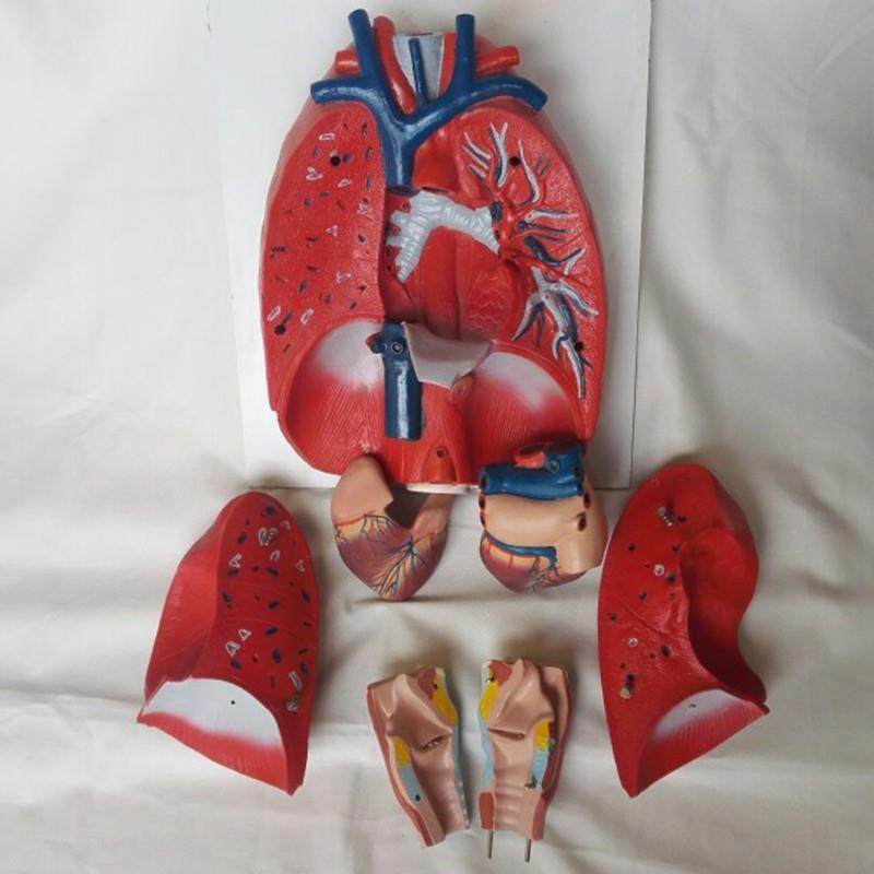 人体肺部解剖模型肺模型教学医用T人体标本模型,淘宝优惠券,粉丝福利购,淘宝优惠卷