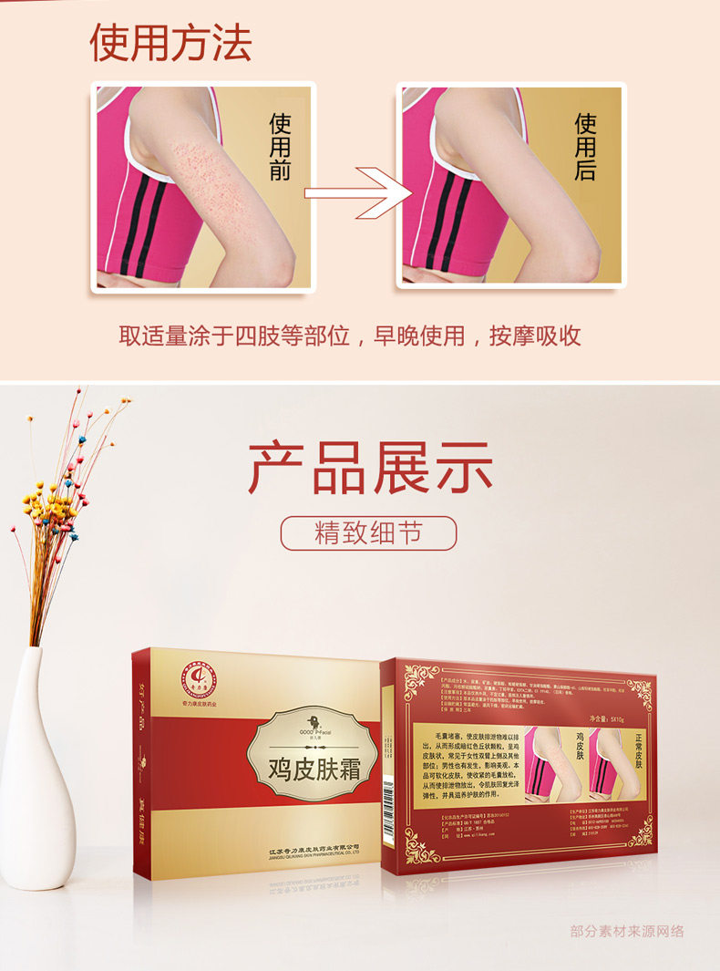 奇力康鸡皮肤疙瘩毛囊角化霜软化 心蕊医疗器械皮肤消毒护理（消）