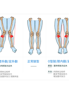 成人儿童宝宝腿型矫正带O型腿X型矫正支架腿部罗圈腿百倍特矫正器