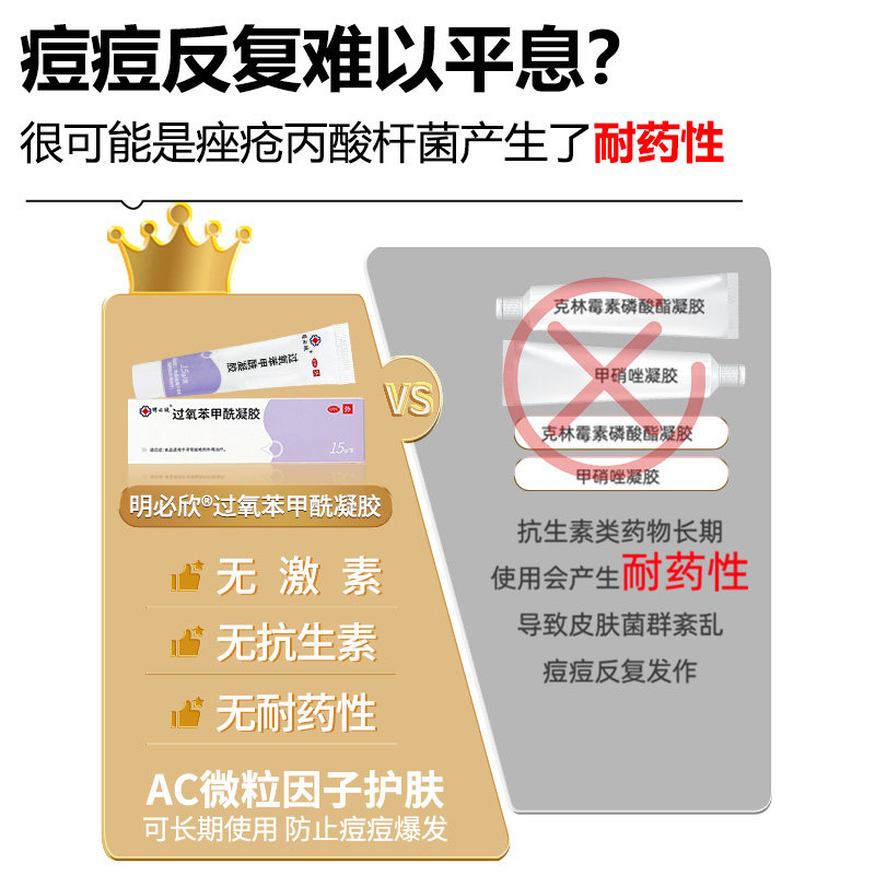 明必欣过氧苯甲酰凝胶bpo正品医用过氧化祛痘痤疮乳膏班赛软膏,淘宝优惠券,粉丝福利购,淘宝优惠卷