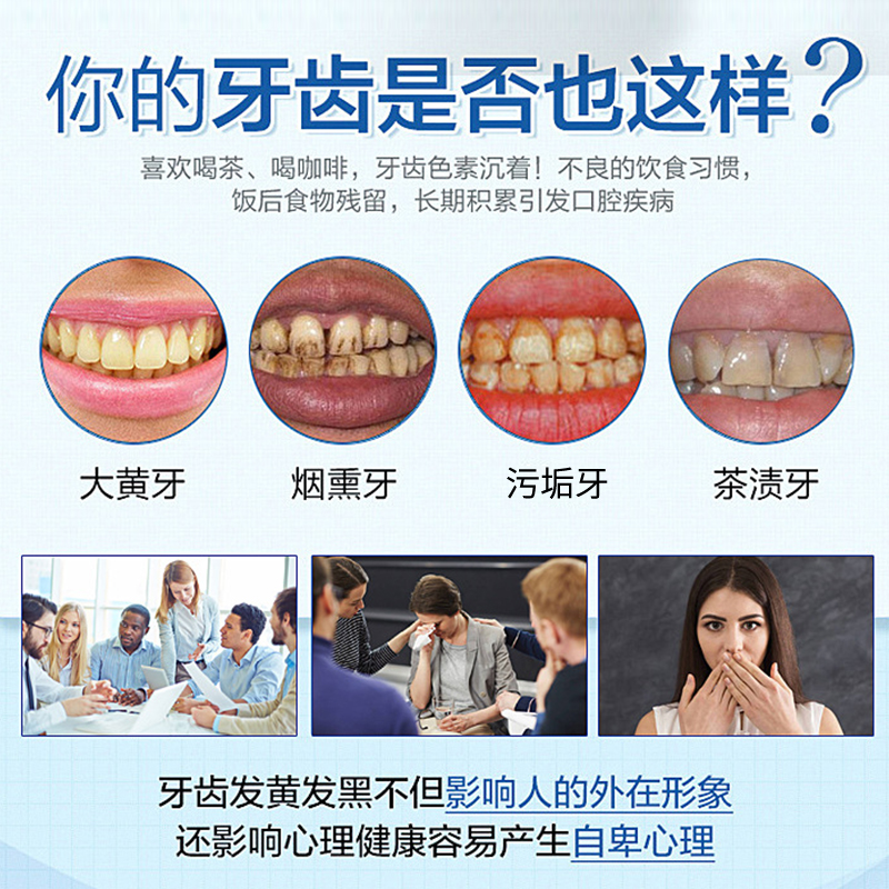 牙齿美白涂抹式牙贴去黄烟渍牙垢炫亮变白美牙笔速效亮白神器凝胶 - 图1
