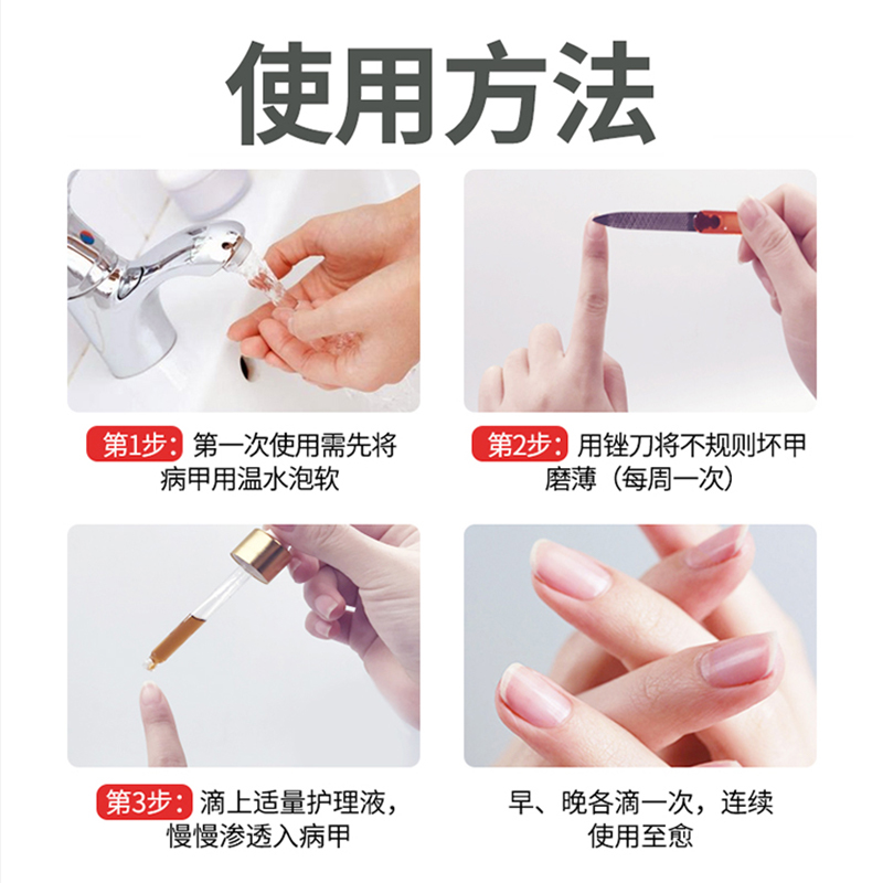 南京同仁堂灰指甲抑菌液去灰甲软甲脱甲甲沟炎指甲增厚专用膏正品
