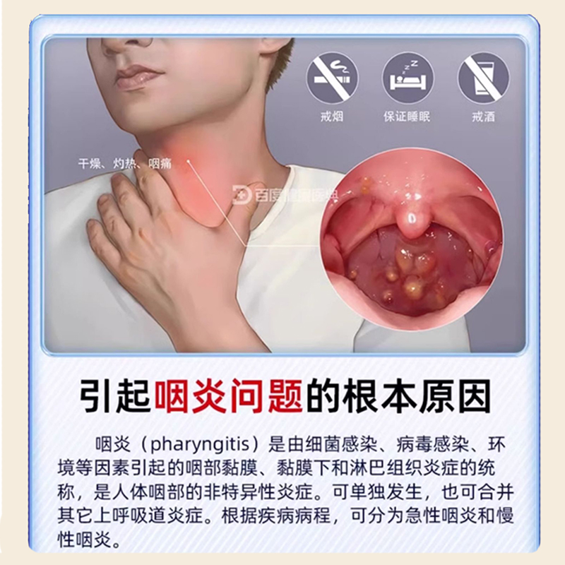 南京同仁堂嗓子老有痰喉咙有痰异物感咽喉炎肿痛痒咳嗽发炎喷雾剂