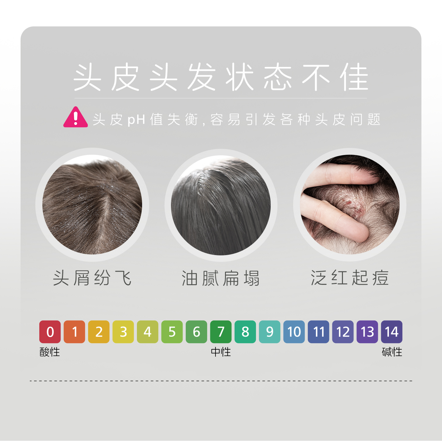 sebamed施巴无硅油去屑洗发水控油蓬松去屑止痒清爽持久留香200ml