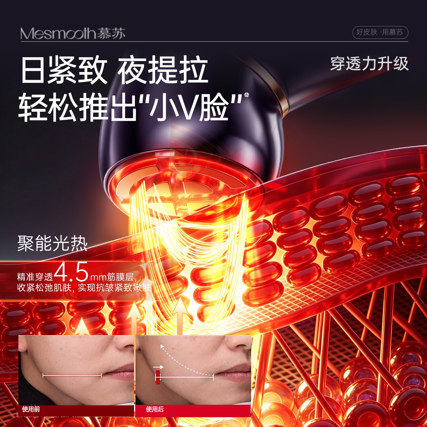 慕苏美容仪器家用脸部提拉紧致脸部按摩仪抗皱美容仪眼部导入仪