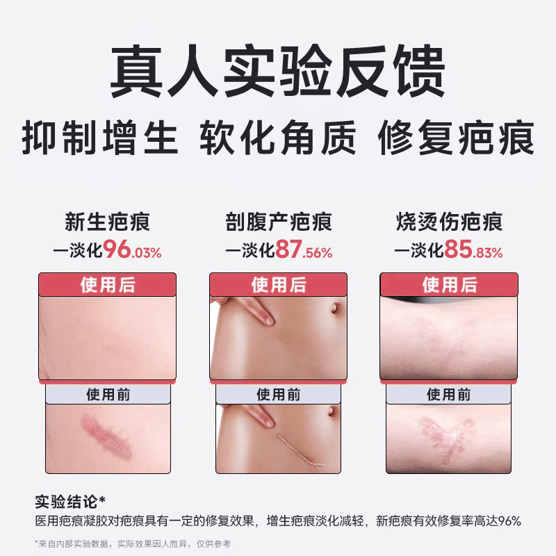 医用硅酮凝胶祛疤膏去剖腹产疤痕贴增生凸起儿童摔烫伤手术旗舰店