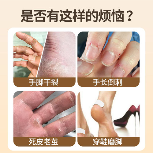 凡士林干裂贴手足皲裂专用防开裂口胶布护手指脚后跟秋冬独立包装 - 图0