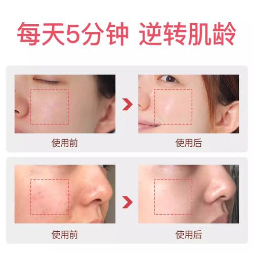 冷热敷美容仪面部精华导入仪器冰敷收缩毛孔家用充电热导热敷仪器 - 图2
