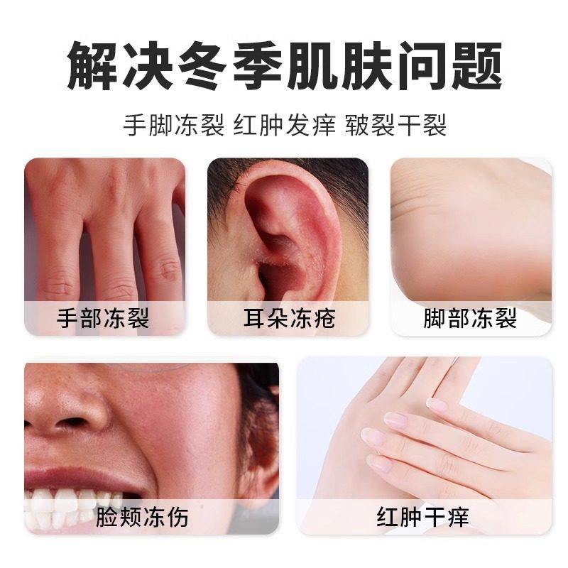 云南本草冻疮膏非止痒冻伤膏官方旗舰店正品防冻裂手足耳朵ru,淘宝优惠券,粉丝福利购,淘宝优惠卷