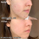 Yilian hyaluronic acid hydrating spray refreshing