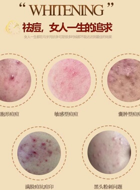 俏贝颜草本祛痘霜十八容颜膏粉刺闭口深层修护舒缓青春痘坑印正品
