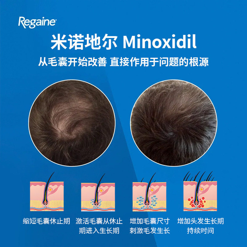 欧洲直邮Regaine落健Rogaine培健米诺地尔生发泡沫男士防脱生发液