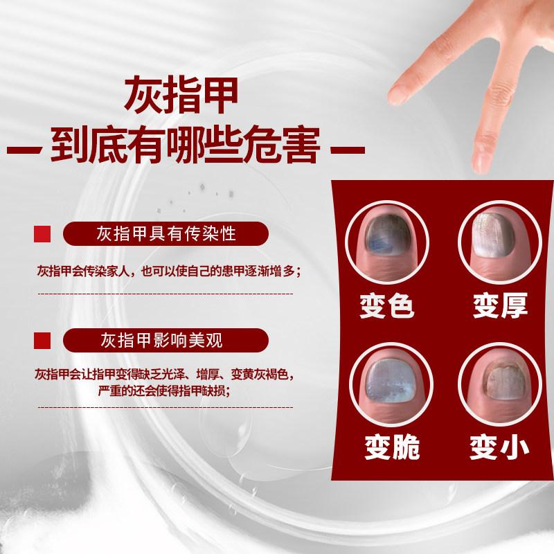 亮甲巩固套餐复方聚维酮碘专用药 亮甲癣症