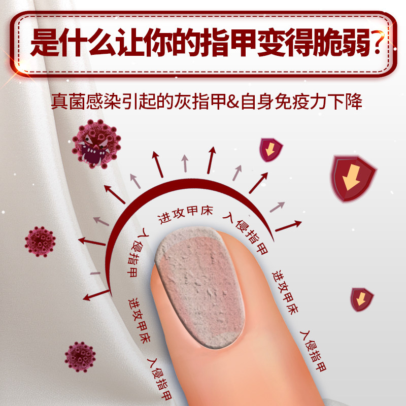 疗程3盒亮甲官网正品灰指甲甲癣液 亮甲癣症