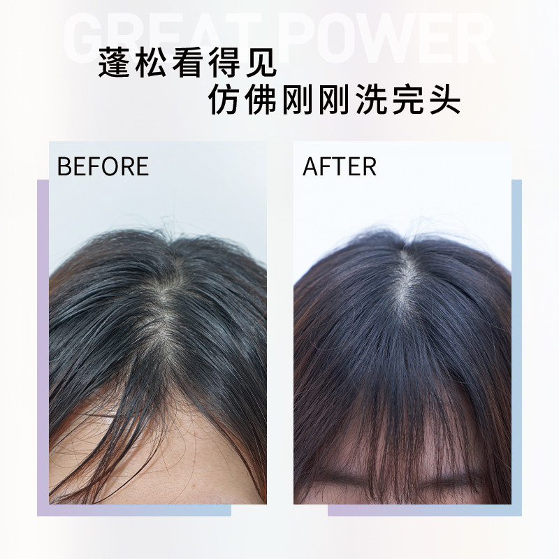 植观蓬蓬粉头发蓬松神器刘海去油 植观红动头发造型