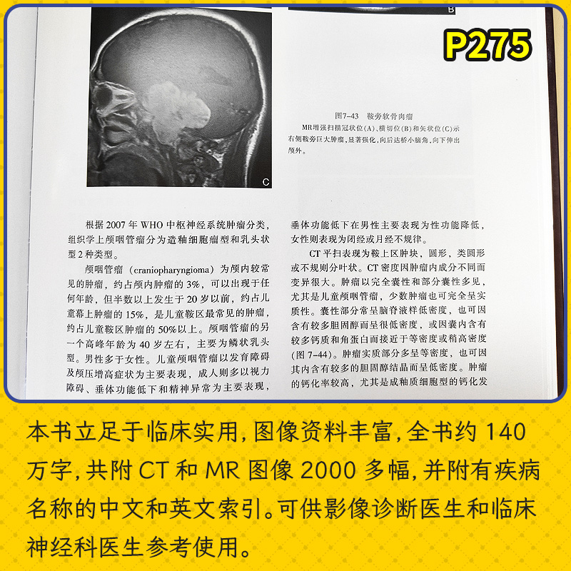 中枢神经系统CT和MR鉴别诊断 第3版 鱼博浪 影像医学疾病颅脑核磁共振超声内科学诊断层解剖学图谱手册检查中枢神经医学影像学书籍