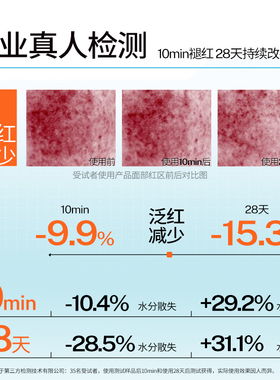 福瑞达诠润B5舒缓修护面霜