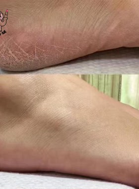 泰国正品金象牌香蕉精华护肤膏