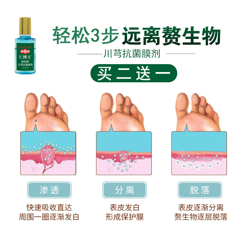 鸡眼膏去鸡眼药水贴根老茧足部 大黄蜂保健品足部健康