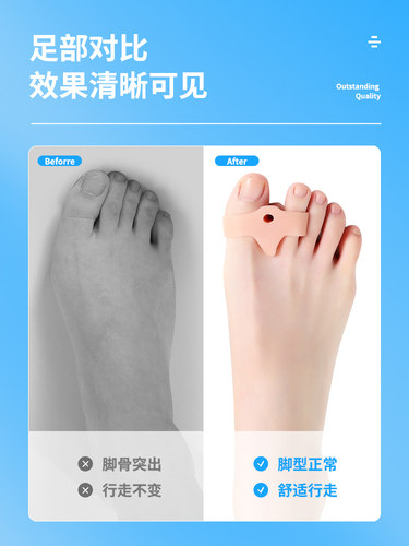 日本硅胶大脚趾拇指外翻矫正器姆外翻大脚骨纠正男女可穿鞋日夜用 - 图3