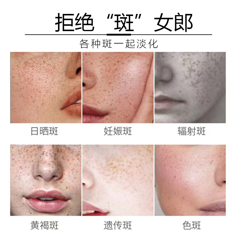 李永康美白提亮肤色滋润霜祛斑膏 李永康乳液/面霜