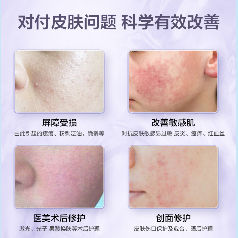 贝毕宁透明质酸医用镇定敏感凝胶 贝毕宁伤口敷料