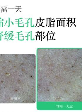 森特莲马达加茶树粉AC精华粉啫喱