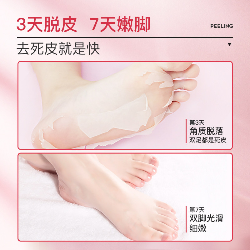 泉兮去脚死皮老茧嫩白脚后跟脚膜 quarxery泉兮足膜