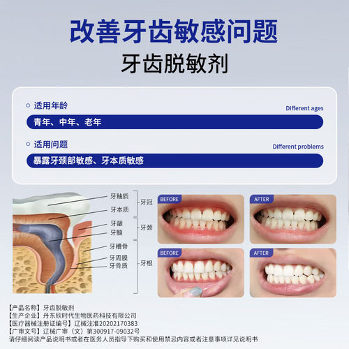 优齿乐牙齿脱敏剂牙龈敏感过敏减轻预防敏感预防龋齿官方正品 - 图3