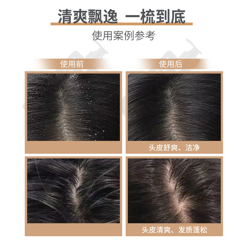 半岛草本植萃洗发水400g清洁蓬松人参当归何首乌姜根山茶籽提取物,淘宝优惠券,粉丝福利购,淘宝优惠卷