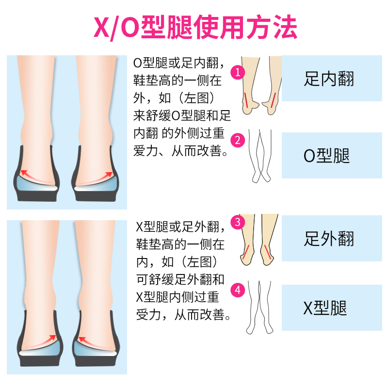 O型腿罗圈腿矫正腿型神器 热品库 性价比省钱购