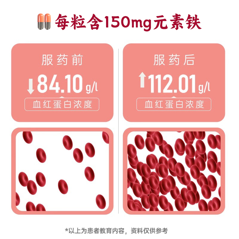 力蜚能多糖铁复合物胶囊30粒/盒 单纯性缺铁贫血孕妇哺乳期正品