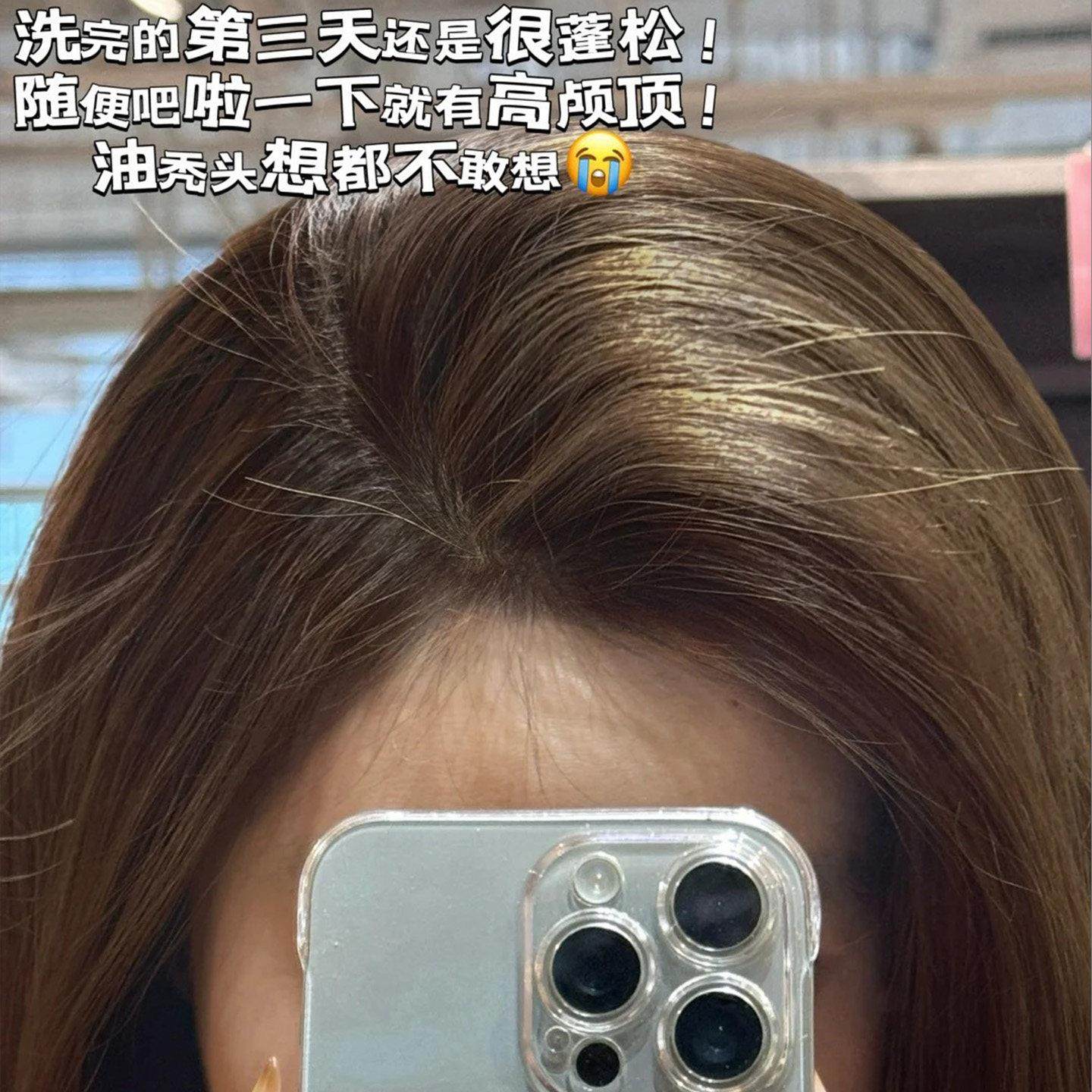 洗头刷子FaSoLa双齿刷按摩梳男女士头部经络刷清洁头皮专用发神器,淘宝优惠券,粉丝福利购,淘宝优惠卷