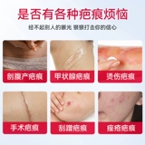 Прозрачный гиалуронат натрия, гель, восстанавливающий послеродовой бондаж