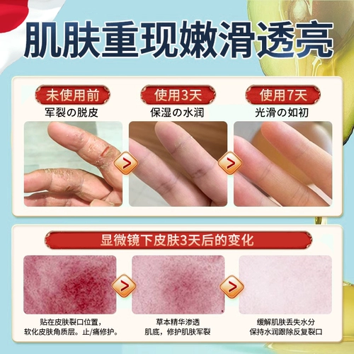 Лента, крем для рук для ступней, против трещин