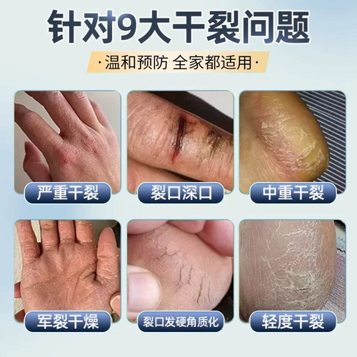 Лента, крем для рук для ступней, против трещин