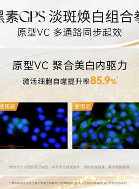 春日来信VC美白淡斑贴片面膜维C改善黄黑皮黯沉白净肤色补水保湿