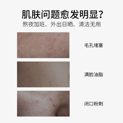 敷益清绿膜水杨酸祛痘控油补水保湿毛孔闭口粉刺黑头非果酸面膜 - 图0