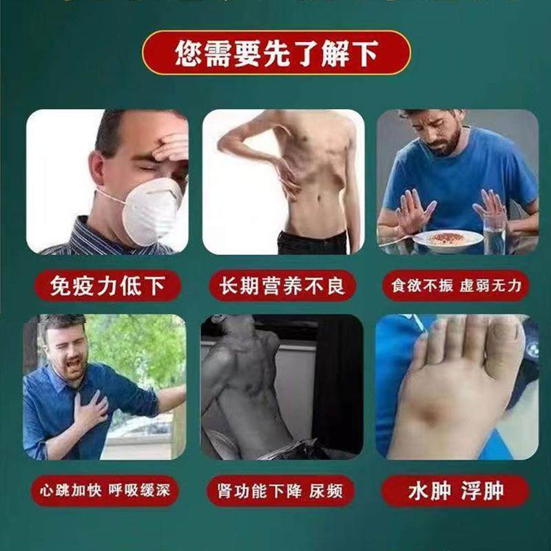 蛋白尿清王尿有泡沫异味尿液浑浊尿蛋白高鸡内金茯苓片蛋白尿多用,淘宝优惠券,粉丝福利购,淘宝优惠卷