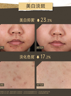 言之有物577精华液30支淡斑美白