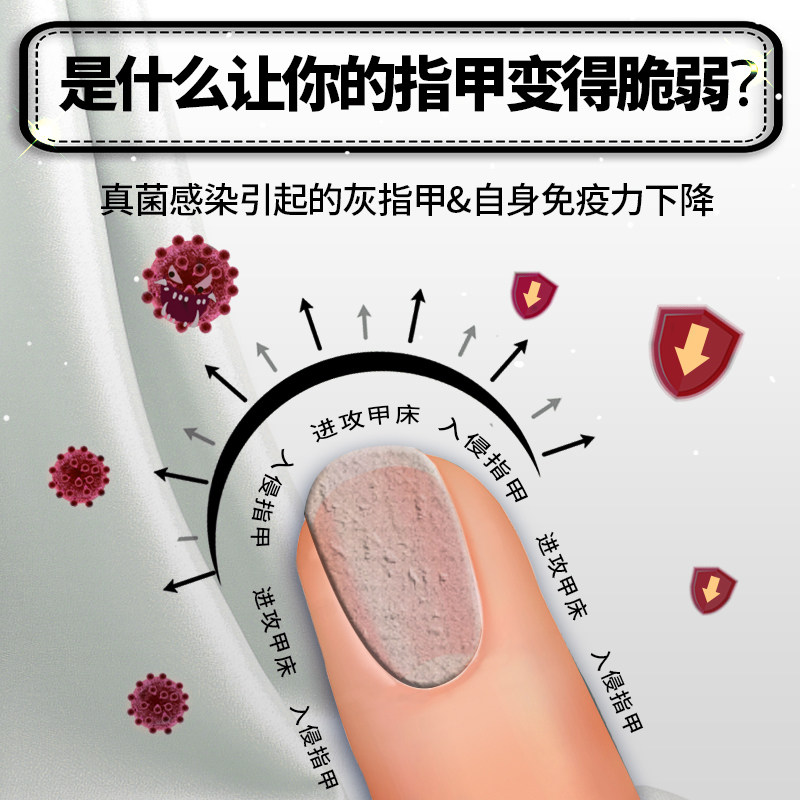 北京同仁堂灰指甲专用抑菌液外用jw 绿洲大药房保健理疗