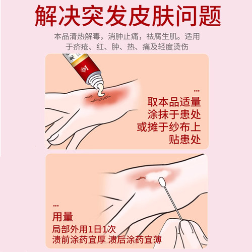 马应龙龙珠软膏20g红肿药膏烫伤膏褥疮痤疮虫咬皮炎中药消炎 - 图1