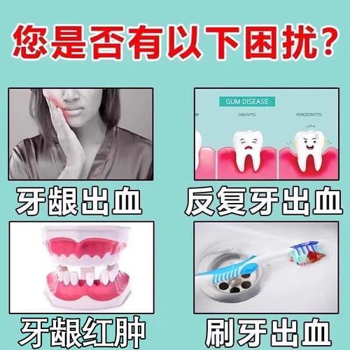 云南白药牙膏官方旗舰店正品品牌治I牙周口腔牙龈炎消止炎痛YB - 图1