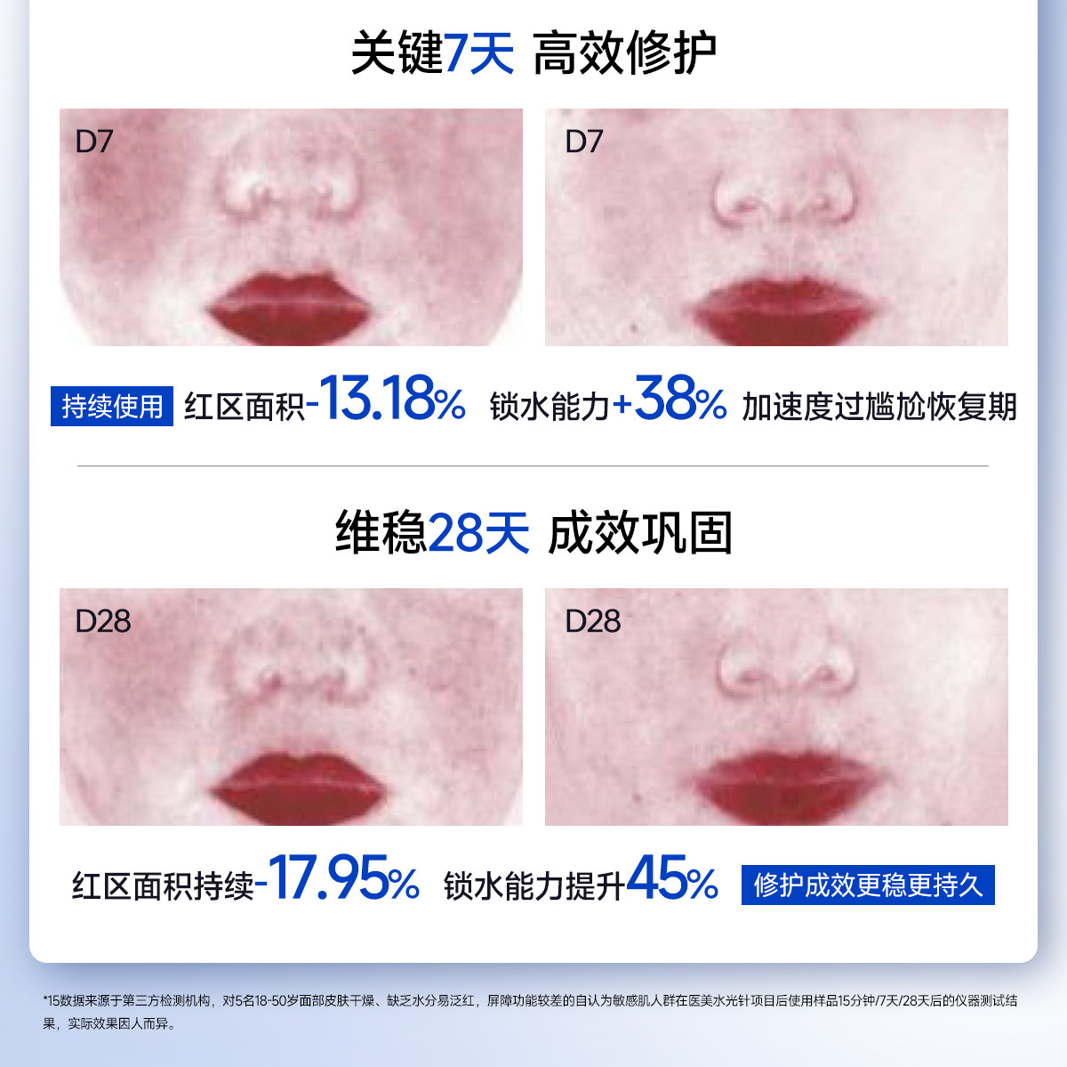 皮宝舒缓屏障修护霜7.5g敏肌屏障修护保湿PDRN屏障霜收货返20元券 皮宝舒缓屏障修护霜7.5g敏肌屏障修护保湿PDRN屏障霜收货返20元券