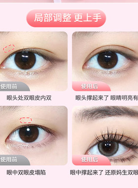 局部双眼皮贴蕾丝超薄隐形自然