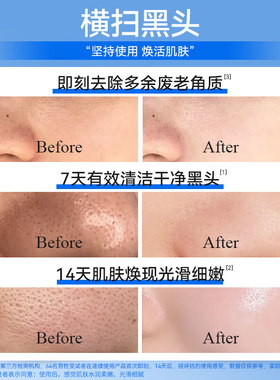 百雀羚净黑头保湿净肤洁面膏