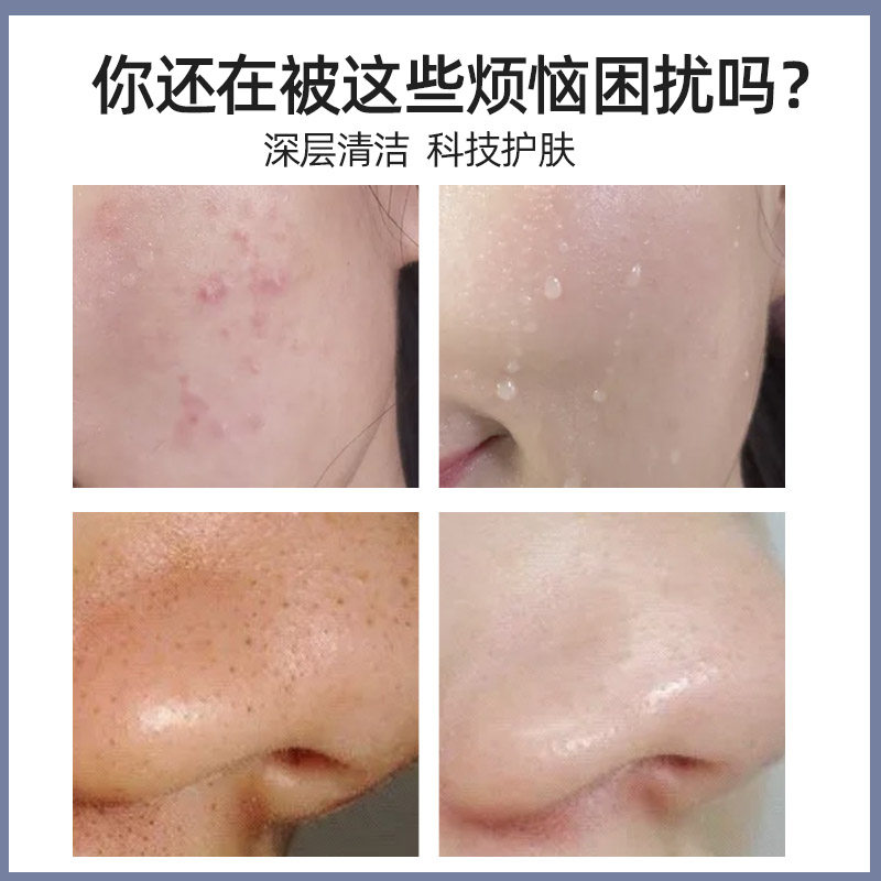 韩俪娅六代氢氧大气泡面部清洁注氧 韩俪娅电子美容仪