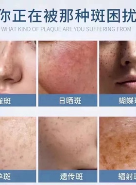控色液三件套无尴尬期调肤反黑